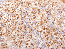 Anti-ACTH antibody [2F6] used in IHC (Paraffin sections) (IHC-P). GTX34389