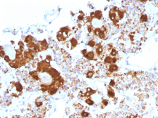 Anti-ACTH antibody [CLIP/1407] used in IHC (Paraffin sections) (IHC-P). GTX34391