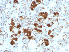 Anti-ACTH antibody [SPM501] used in IHC (Paraffin sections) (IHC-P). GTX34392