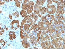 Anti-ACTH antibody [CLIP/1449] used in IHC (Paraffin sections) (IHC-P). GTX34393