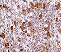 Anti-ACTH antibody [AH26] used in IHC (Paraffin sections) (IHC-P). GTX34394