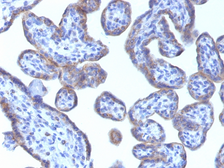 Anti-ADFP antibody [ADFP/1493] used in IHC (Paraffin sections) (IHC-P). GTX34397