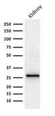 Anti-Adiponectin antibody [ADPN/1370] used in Western Blot (WB). GTX34399