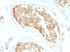 Anti-ALDH1A1 antibody [ALDH1A1/1381] used in IHC (Paraffin sections) (IHC-P). GTX34400