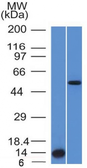 Anti-ALK antibody [ALK/1503] used in Western Blot (WB). GTX34401