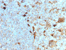 Anti-alpha 1 Antitrypsin antibody [AAT/1378] used in IHC (Paraffin sections) (IHC-P). GTX34403