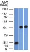 Anti-alpha 1 Antitrypsin antibody [AAT/1378] used in Western Blot (WB). GTX34403