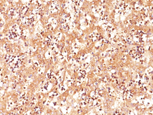 Anti-Alpha fetoprotein / AFP antibody [C3] used in IHC (Paraffin sections) (IHC-P). GTX34405