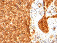 Anti-Alpha fetoprotein / AFP antibody [SPM334] used in IHC (Paraffin sections) (IHC-P). GTX34406