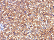 Anti-Alpha fetoprotein / AFP antibody [C2] used in IHC (Paraffin sections) (IHC-P). GTX34407