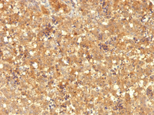Anti-Alpha fetoprotein / AFP antibody [MBS-12] used in IHC (Paraffin sections) (IHC-P). GTX34408