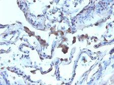 Anti-AMACR antibody used in IHC (Paraffin sections) (IHC-P). GTX34409