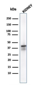 Anti-AMACR antibody [AMACR/1723] used in Western Blot (WB). GTX34410