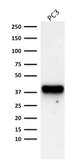 Anti-AMACR antibody [AMACR/1723] used in Western Blot (WB). GTX34410