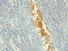 Anti-AMPD3 antibody [AMPD3/901] used in IHC (Paraffin sections) (IHC-P). GTX34411