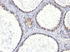 Anti-Androgen Receptor antibody [AR441] used in IHC (Paraffin sections) (IHC-P). GTX34412
