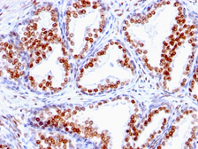 Anti-Androgen Receptor antibody [SPM335] used in IHC (Paraffin sections) (IHC-P). GTX34413