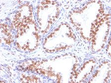 Anti-Androgen Receptor antibody [DHTR/882] used in IHC (Paraffin sections) (IHC-P). GTX34414