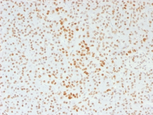 Anti-ATRX antibody [39f] used in IHC (Paraffin sections) (IHC-P). GTX34418