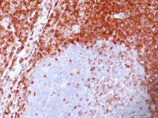 Anti-Bcl-2 antibody [100/D5] used in IHC (Paraffin sections) (IHC-P). GTX34425
