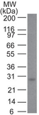 Anti-Bcl-2 antibody [100/D5] used in Western Blot (WB). GTX34425
