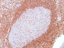 Anti-Bcl-2 antibody [SPM117] used in IHC (Paraffin sections) (IHC-P). GTX34426