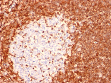 Anti-Bcl-2 antibody [8C8] used in IHC (Paraffin sections) (IHC-P). GTX34427