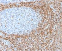 Anti-Bcl-2 antibody [SPM530] used in IHC (Paraffin sections) (IHC-P). GTX34428