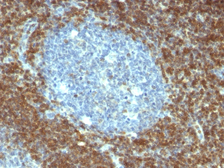 Anti-Bcl-2 antibody [BCL2/796] used in IHC (Paraffin sections) (IHC-P). GTX34430