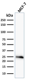 Anti-Bcl-2 antibody [BCL2/796] used in Western Blot (WB). GTX34430