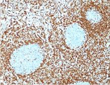 Anti-Bcl-2 antibody [124] used in IHC (Paraffin sections) (IHC-P). GTX34431