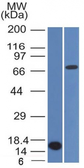 Anti-BCL6 antibody [BCL6/1475] used in Western Blot (WB). GTX34432