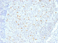 Anti-BCL6 antibody [BCL6/1526] used in IHC (Paraffin sections) (IHC-P). GTX34433