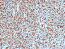 Anti-BCL6 antibody [BCL6/1527] used in IHC (Paraffin sections) (IHC-P). GTX34434