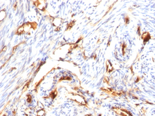Anti-beta 2 Microglobulin antibody [B2M/1118] used in IHC (Paraffin sections) (IHC-P). GTX34435