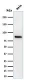 Anti-beta Catenin antibody [15B8] used in Western Blot (WB). GTX34439