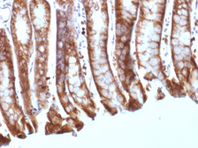 Anti-beta Catenin antibody [CTNNB1/1508] used in IHC (Paraffin sections) (IHC-P). GTX34443