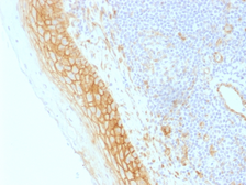 Anti-beta Catenin antibody [CTNNB1/1509] used in IHC (Paraffin sections) (IHC-P). GTX34444