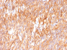 Anti-Calnexin antibody [CANX/1541] used in IHC (Paraffin sections) (IHC-P). GTX34446