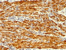Anti-Calponin 1 antibody [SPM169] used in IHC (Paraffin sections) (IHC-P). GTX34447