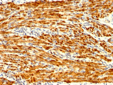 Anti-Calponin 1 antibody [CNN1/1408R] used in IHC (Paraffin sections) (IHC-P). GTX34450