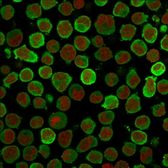 Anti-Calponin 1 antibody [CALP] used in Immunocytochemistry/ Immunofluorescence (ICC/IF). GTX34451