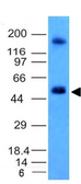 Anti-Carbonic Anhydrase IX antibody [CA9/781] used in Western Blot (WB). GTX34452