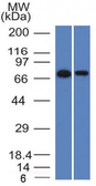 Anti-CD105 antibody [ENG/1327] used in Western Blot (WB). GTX34454
