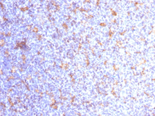 Anti-CD11c antibody [ITGAX/1284] used in IHC (Paraffin sections) (IHC-P). GTX34457