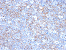 Anti-CD146 antibody [C146/634] used in IHC (Paraffin sections) (IHC-P). GTX34460