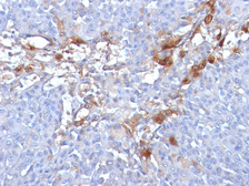 Anti-CD146 antibody [MUC18/1130] used in IHC (Paraffin sections) (IHC-P). GTX34461