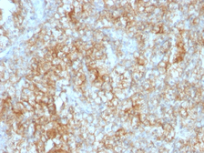 Anti-CD147 antibody [8D6] used in IHC (Paraffin sections) (IHC-P). GTX34462