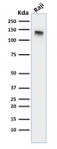 Anti-CD22 antibody [BLCAM/1795] used in Western Blot (WB). GTX34478