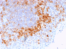 Anti-CD27 antibody [LPFS2/1611] used in IHC (Paraffin sections) (IHC-P). GTX34479